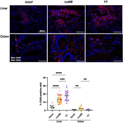 Genotoxin-producing Salmonella enterica induces tissue-specific types of DNA damage and DNA damage response outcomes